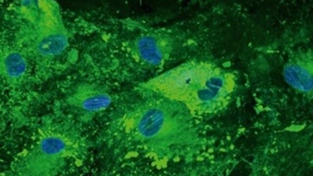 fat-cell1s